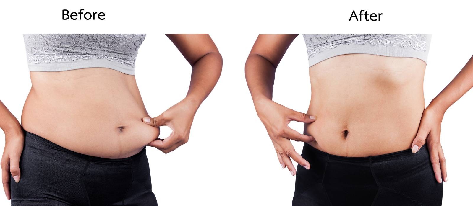 inch-loss-woman